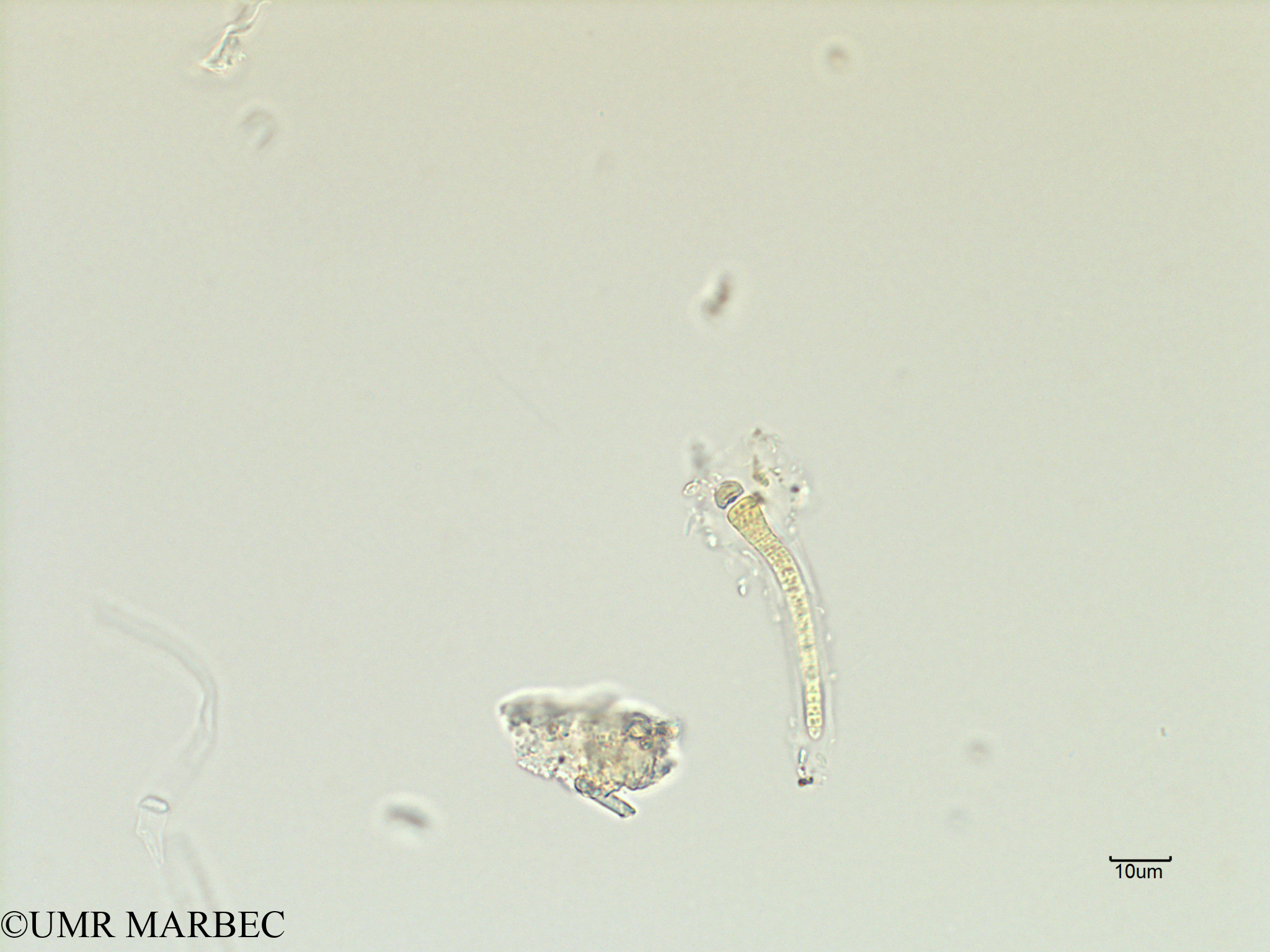 phyto/Scattered_Islands/iles_glorieuses/SIREME November 2015/Calothrix sp1 (SIREME-Glorieuses2015-ech5-231116-photo16 larve-2)(copy).jpg